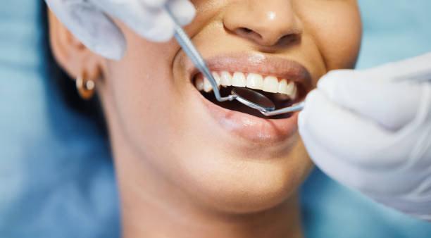 Best Lost Filling or Crown Replacement in Coal City, IL