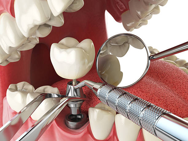 Best Broken or Chipped Tooth Repair in Coal City, IL